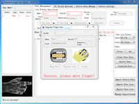 HFSecurity-dispositivo de visualización de venas de dedo, localizador Vien para cuidado de la salud V3000, SDK Linux gratis, precio de fábrica