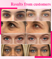 Crème pour les yeux réparatrice des ridules testée par des dermatologues, acide hyaluronique, hydratation intense, hydratation profonde, raffermit et lisse, crème rafraîchissante pour les yeux