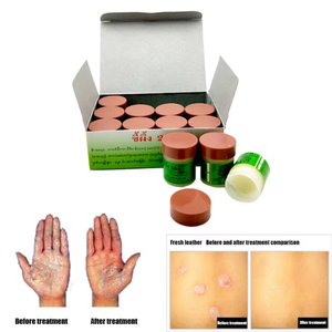 Fórmula Tradicional, para Problemas como Tinea, Eczema, Dermatitis, Acné, etc. - Product Image 2