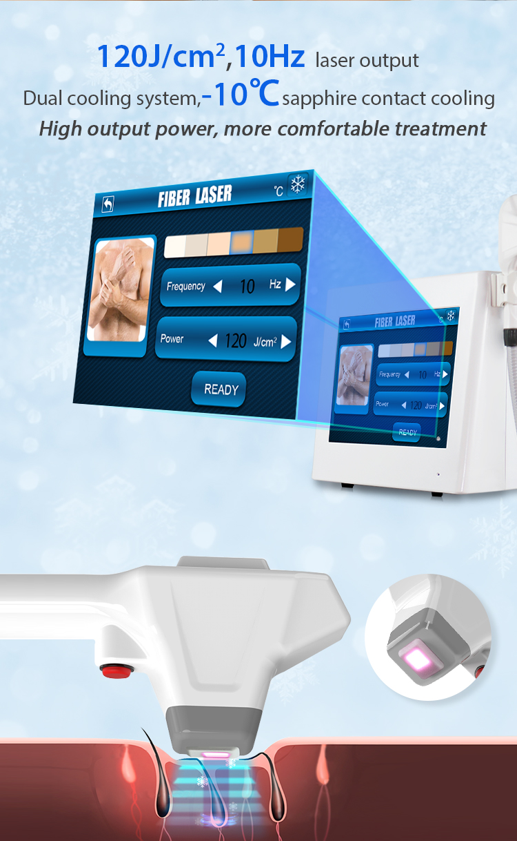 Portable Beauty Applicator 808nm Fiber Laser Hair Removal Machine With Ice Treatment