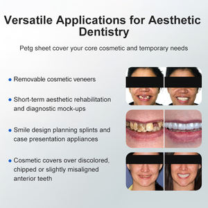 แผ่นฟอร์มสุญญากาศสำหรับทำวีเนียร์ Smile Find Multipurpose Oral Hygiene 510k Ce Snap Veneer 0M1 A2 Shade Dental Vacuum Forming Sheets for Veneers A1 White - Product Image 5