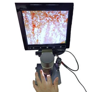 <span class=keywords><strong>Microscope</strong></span> <span class=keywords><strong>USB</strong></span> avec zoom <span class=keywords><strong>400X</strong></span> pour la microcirculation sanguine et le pli des ongles - Product Image 2