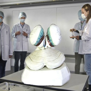 Modello Anatomico dell'Organo del Corpo Umano del Quarto Ventrice con Tessuto Coroidale e Plexo Coroidale per Formazione Medica - Product Image 5