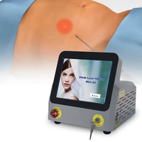 Liposuccion Vaser la plus efficace, laser diode 980 nm, lipolyse, endolaser, lifting, appareil de beauté