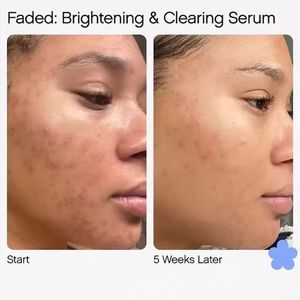 Sérum Crème Visage Éclaircissant Topique 15ml/50ml pour Taches Brunes et Cicatrices Mini Traitement Atténuant pour la Peau - Product Image 2