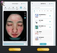 Grande réduction, analyseur de peau de haute qualité, analyseur de cuir chevelu, système d'analyse de la peau du visage 3D intelligent