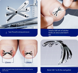 "Kit Corrector de Uñas Encarnadas-Soporte Ajustable de Metal y Silicona para Aliviar el Dolor, Adultos y Niños con Caja de Almacenamiento" - Product Image 5