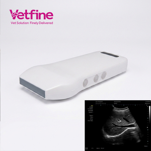 Échographe portable professionnel à sonde convexe noir et blanc pour les soins obstétricaux et urologiques - Product Image 1