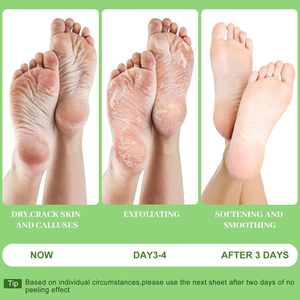 Maschera Esfoliante per Piedi all'Aloe Vera OEM, Calzini Spa per Piedi Secchi e Screpolati, Idratanti e Rimuovi <span class=keywords><strong>Pelle</strong></span> Morta dai <span class=keywords><strong>Talloni</strong></span> - Product Image 5