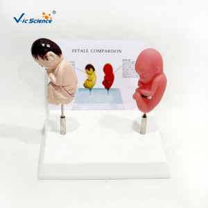 Modèle de démonstration comparatif de fœtus en bonne santé et de fœtus fumeurs à des fins de formation - Product Image 1