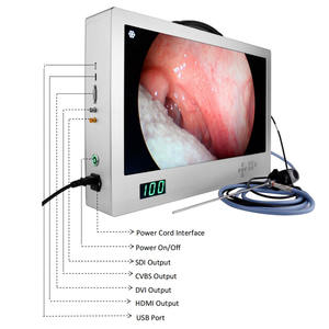 4 इन 1 इंटीग्रेटेड एंडोस्कोप कैमरा सिस्टम ऑल इन वन मेडिकल पोर्टेबल 80w एलईडी कोल्ड लाइट सोर्स एचडी 24 इंच एंडोस्कोप मॉनिटर - Product Image 4