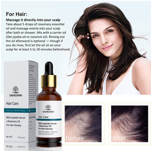 Aceite <span class=keywords><strong>de</strong></span> Tratamiento Capilar Natural <span class=keywords><strong>de</strong></span> Tailandia, Suero para el <span class=keywords><strong>Crecimiento</strong></span> del Cabello con Biotina y Múltiples Péptidos Ordinarios Anticaída - Product Image 3