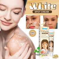 Traitement Sumifun pour le vitiligo : améliore les taches blanches de la peau, pommade pour soulager les taches blanches