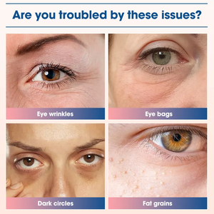 Nouveautés 2025 : Traitement professionnel pour le contour des yeux – Élimine les cernes et stimule la circulation avec <span class=keywords><strong>massage</strong></span> et micro-courant - Product Image 5