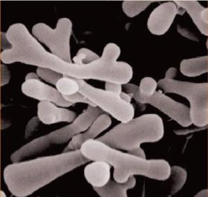 Bifidobacteria Longum de alta pureza personalizada OEM/ODM, polvo de materia prima para bolsita de probióticos, Bifidobacteria Longum, A101 - Product Image 2