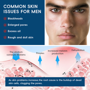 LAIKOU Gommage Visage Exfoliant Doux <span class=keywords><strong>pour</strong></span> Hommes – Élimine <span class=keywords><strong>les</strong></span> <span class=keywords><strong>Points</strong></span> <span class=keywords><strong>Noirs</strong></span>, Réduit <span class=keywords><strong>les</strong></span> Pores Dilatés, l'Excès de Sébum et la Peau Rugueuse et Terne – Peau Propre et Fraîche 50g - Product Image 3
