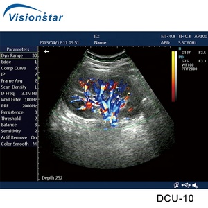 China DCU-10 Color Doppler Portable Veterinary Animal <strong>Ultrasound</strong> <strong>Machine</strong> <strong>for</strong> <strong>Sale</strong> - Product Image 6