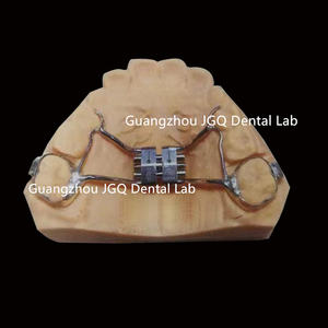 <span class=keywords><strong>Appareil</strong></span> orthodontique personnalisable de haute qualité, extenseur d'arc <span class=keywords><strong>dentaire</strong></span> pour les dentistes et les laboratoires - Product Image 4
