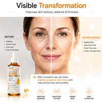 Sérum de soin de la peau à l'acide hyaluronique, à la niacinamide et à la super vitamine C pour la réduction des rides du visage, des taches de vieillesse, le raffermissement, le lifting et l'hydratation, 30 ml pour