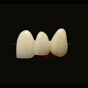 Laboratorio dentale eccellente precisione protesi fisse utilizzando materiale ceramico Zirconia porcellane tutte le corone e ponte in ceramica - Product Image 6