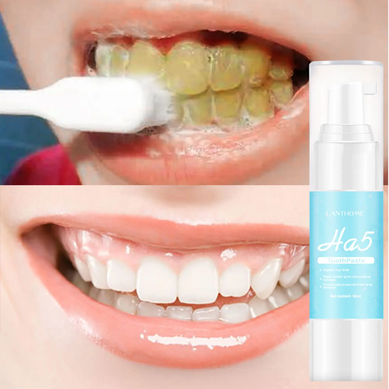 LANTHOMEヒアルロン酸HA5汚れを取り除く黄色い歯口臭呼吸ホワイトニング歯の修理フォームムース歯磨き粉