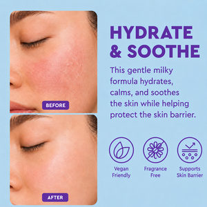 Tónico Humectante con Ceramidas ODM para Piel Sensible, Hidratación Intensa, Calma la Irritación y el Enrojecimiento, Repara el Daño por Quemaduras Solares - Product Image 3