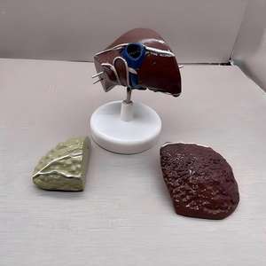 Modèle de Pathologie du Cancer du Foie avec Base - Spécimen Pédagogique d'Hépatologie - Product Image 4