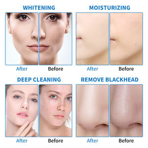 Máquina Facial Multifunción 6 en 1 para Rejuvenecimiento Facial, Reabastecimiento de Nutrientes, Antiarrugas, Hidratación y Masaje Facial - Product Image 2