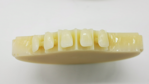 Migliore qualità <span class=keywords><strong>PMMA</strong></span> blocco dentale da laboratorio monostrato multistrato 98 95 92*75mm disco dentale ad alte prestazioni materiali di consumo dentale - Product Image 5