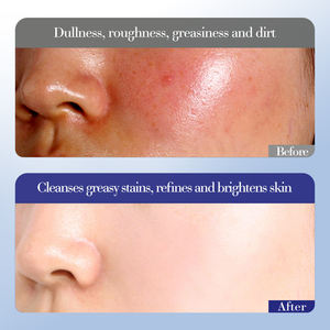 プライベートラベルSADOERイブニングプリムローズビタミン<span class=keywords><strong>E</strong></span>フェイシャルスキンケアセット保湿フェイススーツ修理乾燥性改善ギフトボックス - Product Image 5