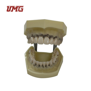Modelo de Enfermedad Periodontal con Encía Transparente que Demuestra la Recesión Gingival para la Educación del Paciente en Clínicas Dentales - Product Image 5