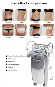 4D V Shape Roller Massage Cellulite Reduction Machine <b>Standing</b> Multi Handle Touch <b>Screen</b> Personal Care Massager - Product Image 6