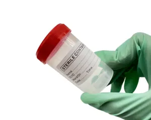 一次性尿液收集杯医用无菌样品标本收集30毫升60毫升120毫升尿液容器塑料标本杯
