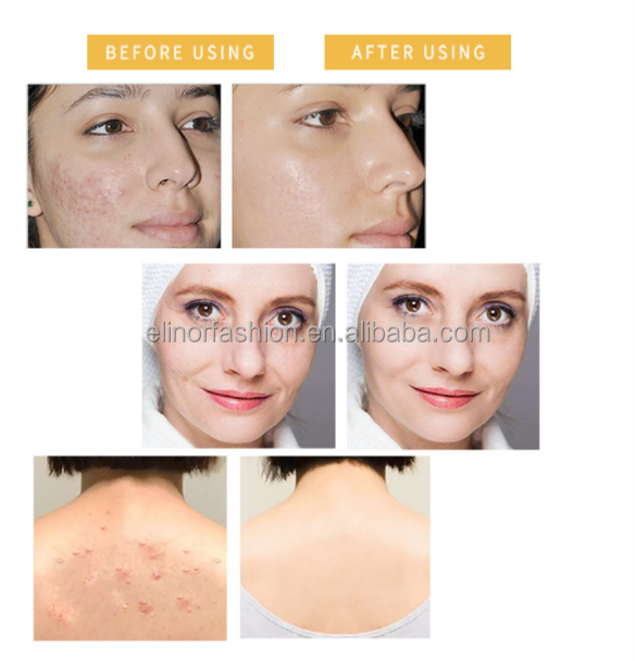 buy whitening body soap,bleaching soap whitening,skin