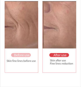 พิธีกรรมเรืองแ<span class=keywords><strong>ส</strong></span>ง6-in-1ของคุณทำความ<span class=keywords><strong>ส</strong></span>ะอาดอย่างแน่นหนา & รีเฟรชด้วยอุปกรณ์อัจฉริยะพลา<span class=keywords><strong>ส</strong></span>ติก ABS - Product Image 6