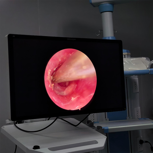 Advanced Surgical Full HD Endoscope Camera Mobile Trolley for Hospital Operating Room Use