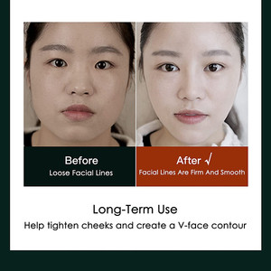 Masajeador eléctrico que moldea la cara en V, instrumento de belleza que moldea la doble barbilla, con control remoto, antiarrugas, rojo, azul - Product Image 6