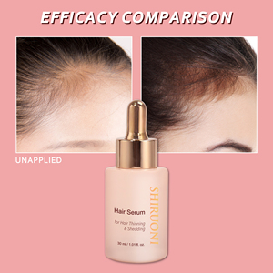 OEM ODM เซรั่ม<span class=keywords><strong>ปลูก</strong></span><span class=keywords><strong>ผม</strong></span>เคราตินจากผักวีแกนธรรมชาติให้ความชุ่มชื้นแก่เส้น<span class=keywords><strong>ผม</strong></span>ไม่ทำให้เกิดการแตก - Product Image 3