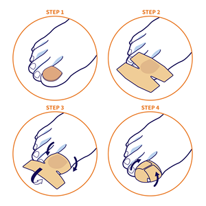 Parche <span class=keywords><strong>de</strong></span> hongos <span class=keywords><strong>en</strong></span> las uñas <span class=keywords><strong>de</strong></span> etiqueta privada, antifúngico Extra fuerte con 40% <span class=keywords><strong>de</strong></span> urea, uñas descoloridas dañadas y frágiles gruesas para manos y pies - Product Image 2