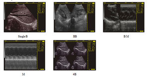 JM-808F Échographe vétérinaire numérique portable noir et blanc pour bovins, chevaux, chiens, chats, moutons - Product Image 6