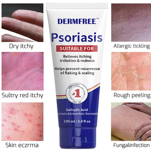 Household Multipurpose Skin Treatment <strong>Ointment</strong> for Itchy Inflamed Scaly Skin on Body Limbs - Product Image 1
