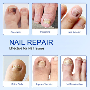21 cái móng chân nấm điều trị nấm Nail sửa chữa các bản vá lỗi cho bị hư hỏng móng tay - Product Image 2