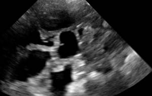 Dawei 휴대용 무선 기계 수의학 초음파 스캐너 돼지 수의학 기기를위한 휴대용 임신 검사기 - Product Image 4