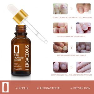 ELAIMEI Esencia para el Tratamiento de Uñas de 30 ml, Antifúngica, Acelera el Metabolismo de las Uñas, Nutre las Uñas de los Pies, Suero Reparador de Uñas - Product Image 5