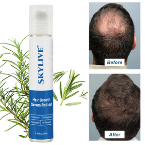 25ml Cheveux Sérum Nourrissant Roll-on Huile Essentielle De Romarin Améliorant Le Cuir Chevelu Nourrissant Renforçant La Racine Des Cheveux Produits De Soins Des Cheveux - Product Image 3