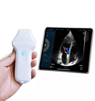 Konted MDR 128 elemen Harga pemindai Ultrasound, pemindai warna nirkabel genggam portabel
