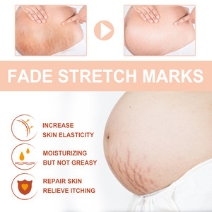La crema de Caracol al por mayor más vendida para <span class=keywords><strong>el</strong></span> cuerpo antiestrías, líneas finas y cicatrices, cuidado suave con piel suave - Product Image 4