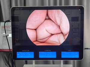 Sistema <span class=keywords><strong>de</strong></span> Endoscopia Médica FHD <span class=keywords><strong>de</strong></span> <span class=keywords><strong>Shrek</strong></span> Endoscopy Manufacturer con Monitor <span class=keywords><strong>de</strong></span> 27 Pulgadas y Grabación - Product Image 3