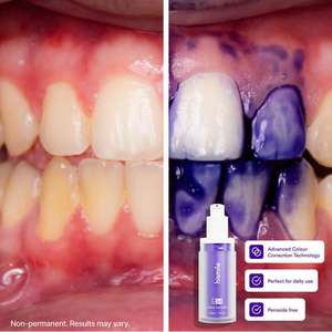 Pasta Dental Blanqueadora de Dientes Morada Personalizada OEM, Kit de Sonrisa, Botella de Color, Líquido <span class=keywords><strong>Corrector</strong></span> <span class=keywords><strong>V34</strong></span>, Hecho en China - Product Image 2