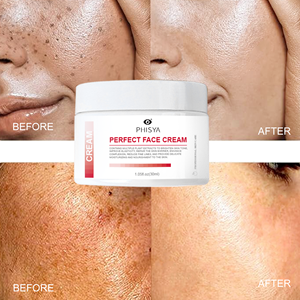 Mascarilla-Crema Facial Blanqueadora Coreana de Día y Noche para Eliminar Manchas Oscuras, Corrector de Pecas, Melasma y Pigmentación - Product Image 3